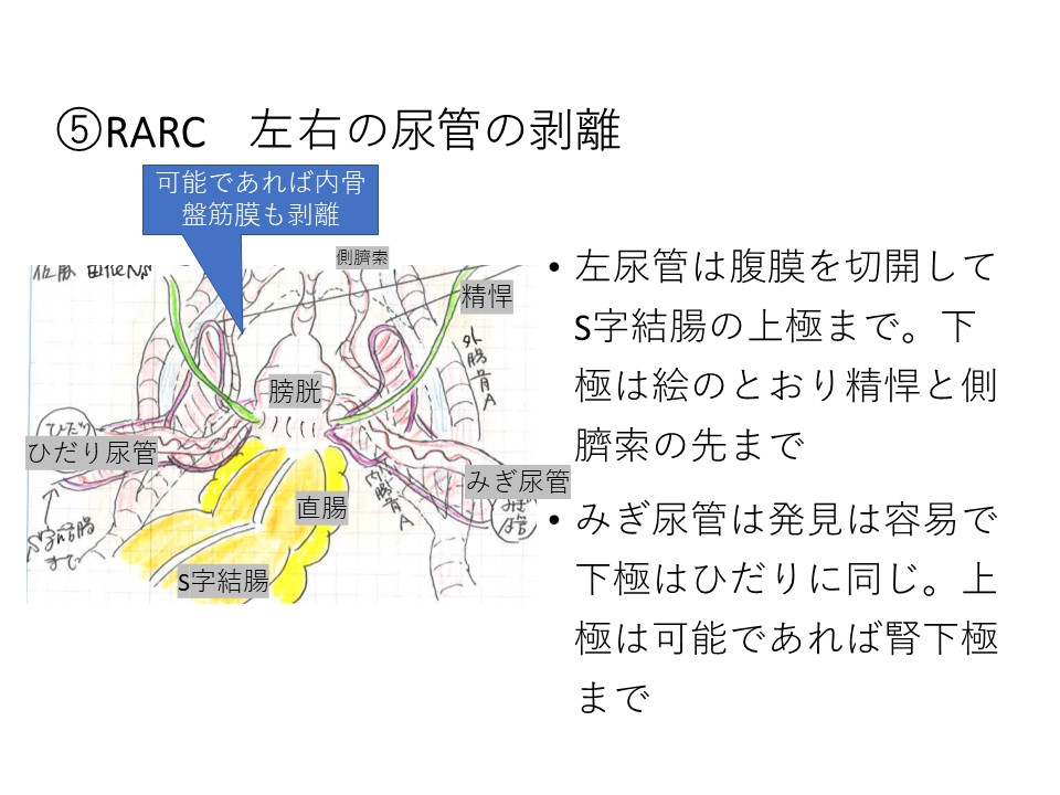 その他のヒント